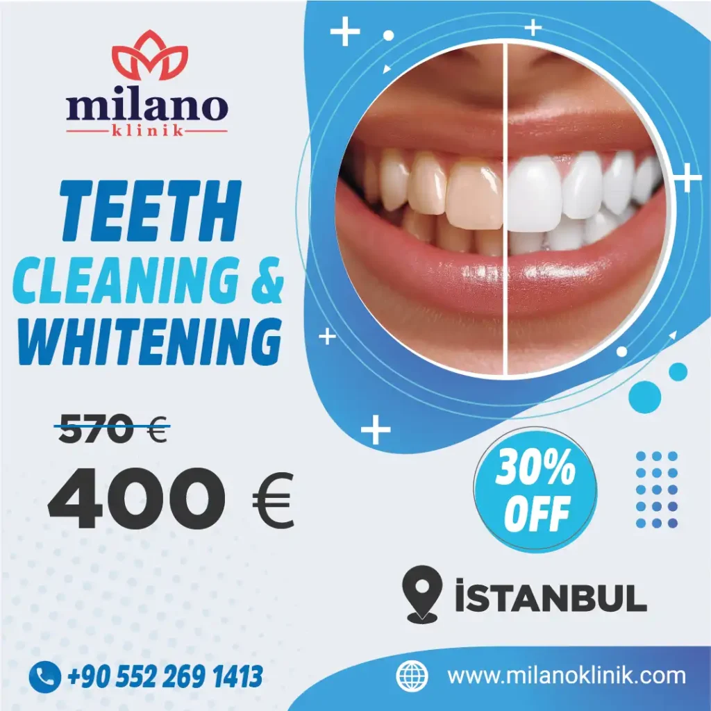 Blanqueamiento Dental