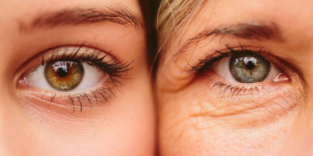 Anti-Aging Eye Treatments