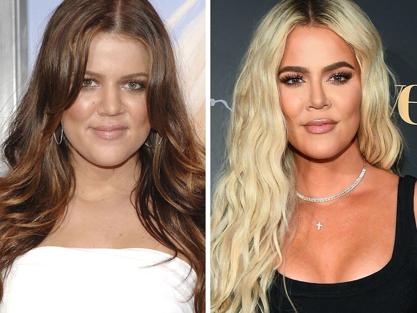 Khloé Kardashian Schönheitsoperationen